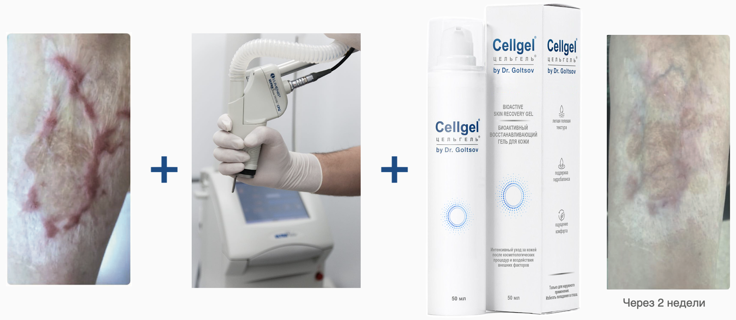 Cellgel® (Цельгель®)
